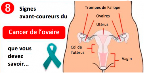 8 signes avant-coureurs du cancer de l’ovaire 
